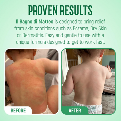 Il Bagno Body Wash for Eczema